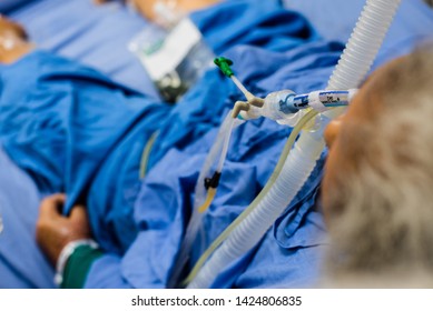 Patient On Endotracheal Tube Ventilator Help Stock Photo 1424806835 ...