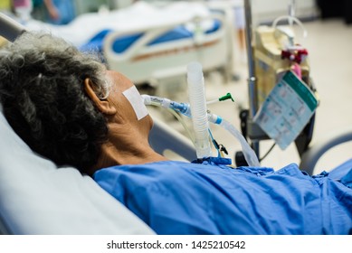 Patient On  Endotracheal Tube With Ventilator For Help Breathing System In ICU.