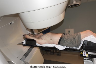 Patient Radiation Therapy Showing Laser Lines For Targeting Cancer Cells In The Brain And Throat