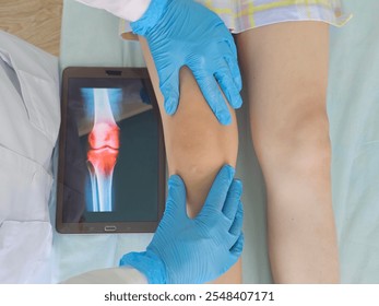 A patient receives a knee examination by a healthcare professional while a digital display shows an image of the knee joint. - Powered by Shutterstock