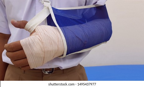 Patient 's Broken Bone Treated By Cast. Traumatic Accidental Injury From Traffic Collision, Workplace Accident, Sport Injury , Physical Abuse Are Cause Of Disability And Death. Insurance Care Concept