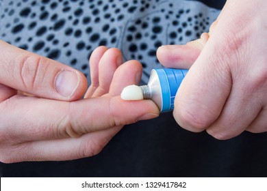 Patient squeezes out of aluminum tubes ointment with medicinal substance on finger. Photo of use of drug in form of ointments for application on skin and treating skin diseases, psoriasis, acne