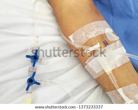 Patient treatment at inpatient unit in hospital by infusions intravenous therapy    via peripheral intravenous catheter (IV cannula) inserted needle to arm vein site for administrating medication