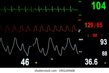 Patient Vital Sign Monitor Display In The Intensive Care Unit.