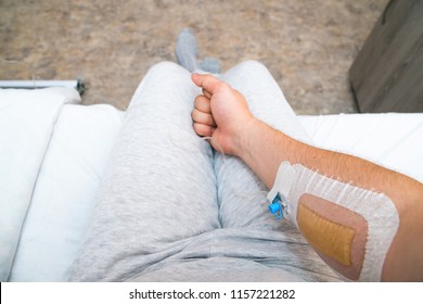 Patient's Hand With Fist With Infusion Catheter. First Person View