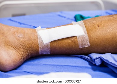 28,520 Wound Care Healing Images, Stock Photos & Vectors 