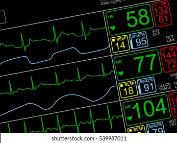 Patient's Vital Signs On ICU Monitor, Isolated Closeup, Dutched Left