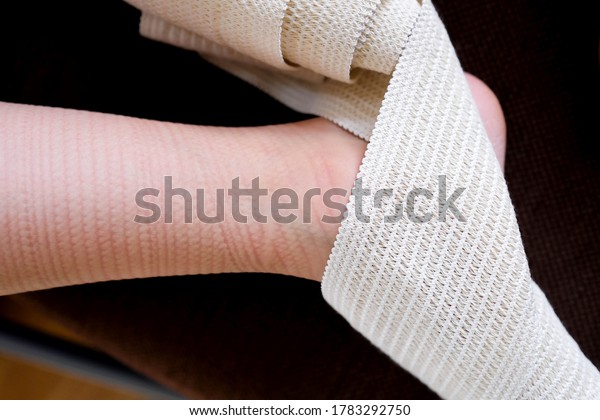 A pattern on the skin from a medical\
bandage. The elastic bandage squeezed the\
skin.