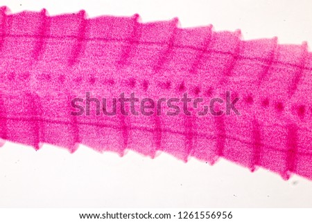 Patterns and backgrounds of Parasitic, Study for Anatomical pathology in laboratory.