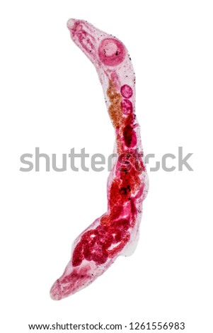 Patterns and backgrounds of Parasitic, Study for Anatomical pathology in laboratory.
