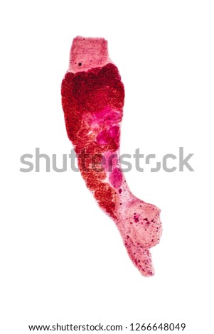 Patterns and backgrounds of Parasitic, Study of Parasitic and Anatomical pathology in laboratory.
