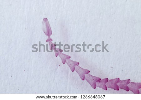 Patterns and backgrounds of Parasitic, Study of Parasitic and Anatomical pathology in laboratory.
