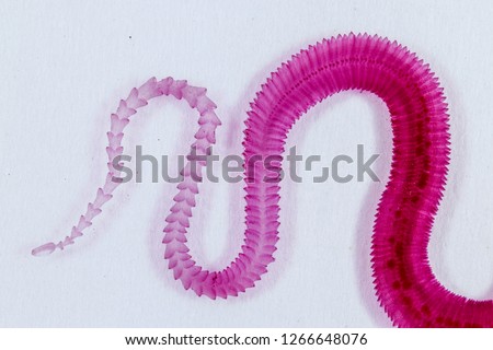 Patterns and backgrounds of Parasitic, Study of Parasitic and Anatomical pathology in laboratory.
