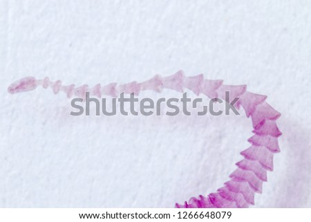 Patterns and backgrounds of Parasitic, Study of Parasitic and Anatomical pathology in laboratory.
