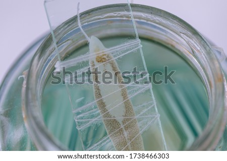 Patterns and backgrounds of Parasitic, Study of Parasitic and Anatomical pathology in laboratory.
