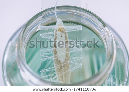 Patterns and backgrounds of Parasitic, Study of Parasitic and Anatomical pathology in laboratory.
