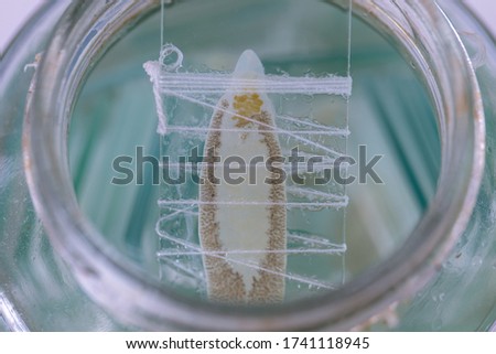 Patterns and backgrounds of Parasitic, Study of Parasitic and Anatomical pathology in laboratory.
