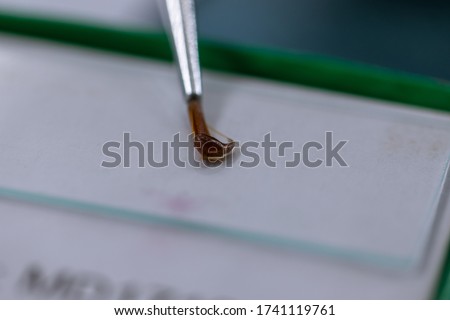 Patterns and backgrounds of Parasitic, Study of Parasitic and Anatomical pathology in laboratory.
