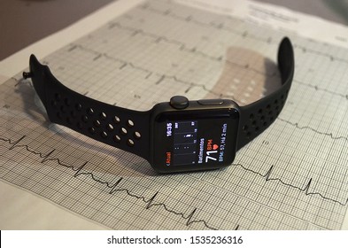 São Paulo/Brazil - October 18 2019: Apple Watch Series 3 On Top Of An Electrocardiogram - Heart Control Help Concept - Open Bracelet
