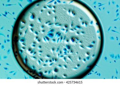 PC-3 human prostate cancer cells in air bubble, stained with Coomassie blue, under differencial interference contrast microscope. - Shutterstock ID 425734615