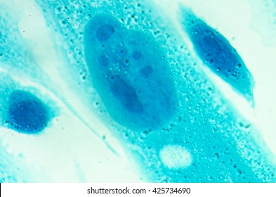 elixir vitae para el cáncer de próstata