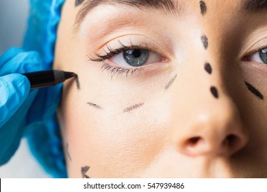 Peaceful young patient with dotted lines on the face in an examination room