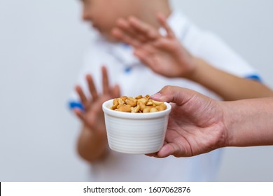 Peanut Food Allergy Concept. Great Concept Of Allergy And Skin Diseases. Nut Allergies. No Peanuts. Food Allergy Symptoms, Irritation