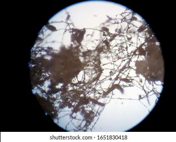 Peanuts Under The Microscope Under The Increase Of Spoiled Mycotoxins Fungi Mold