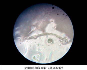 Peanuts Under The Microscope Under The Increase Of Spoiled Mycotoxins Fungi Mold