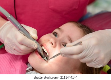 The pediatric dentist treats the child's teeth, examination of the tooth after cleaning from caries. - Powered by Shutterstock