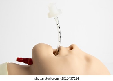 Pediatric Endotracheal Tube Positioned. Airway Management With ETT(endotracheal Tube). Side View