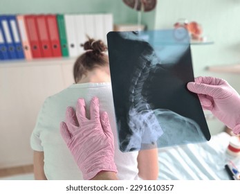 Pediatrician doctor examines x-ray of child spinal deformity concept - Powered by Shutterstock