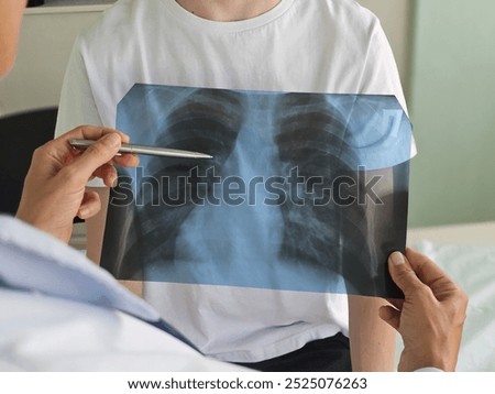 Pediatrician examines a teenage patient with a stethoscope looking at an x-ray of the lungs with pneumonia. Bronchitis and cough