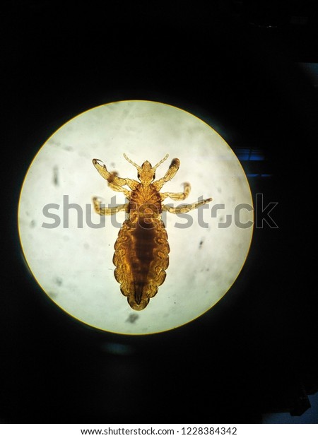 Pediculosis\
capitis(head louse) in light\
microscope
