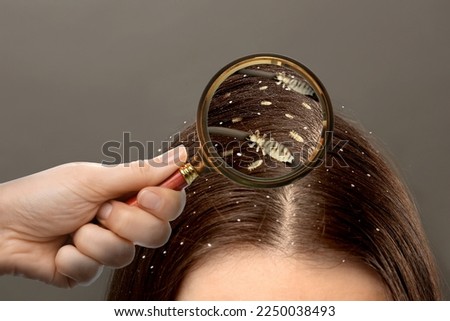 Pediculosis. Woman with lice and nits on grey background, closeup. View through magnifying glass on hair