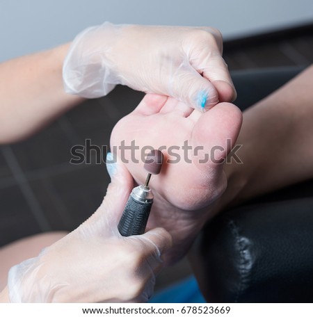 pedicure with an electric nail file 