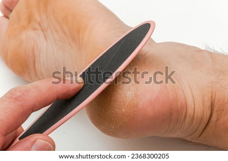 Pedicure file does a pedicure on a cracked heel