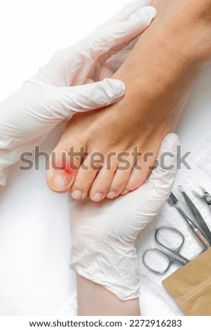 Pedicure, podologist. Patient on medical pedicure procedure, nail disease, cholesis detachment of the nail plate. Foot care, treatment in a medical spa salon.