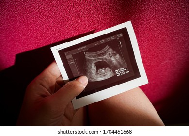 ultrasonido de cribado pélvico, embarazo 10 11 semanas, foto del embrión en el regazo de una mujer con un fondo rosado, esperando a una chica                              