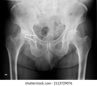 161 The pelvic cavity Images, Stock Photos & Vectors | Shutterstock