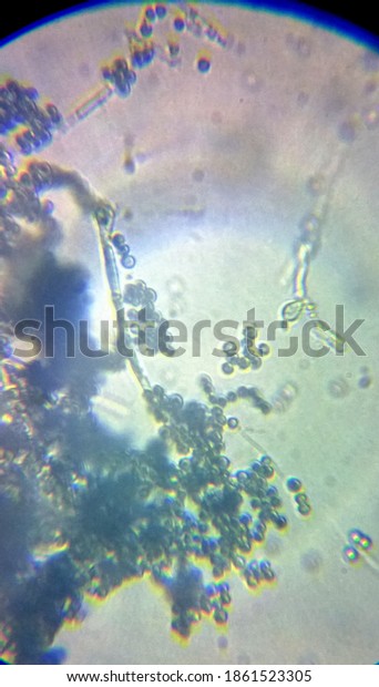 Penicillium Genus Mold Under Microscope Stock Photo 1861523305 ...