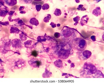 Penicillium Marneffei High Res Stock Images Shutterstock