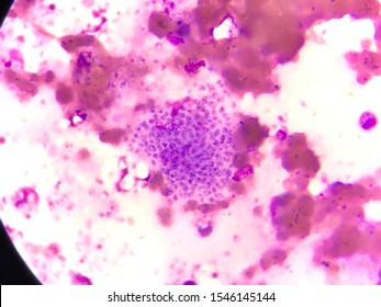 Penicillium Marneffei High Res Stock Images Shutterstock