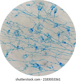 Penicillium sp.conidia and septate hyphae ,under the microscope 400X.