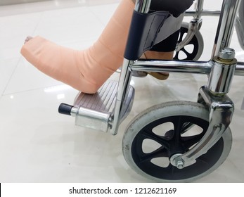 People Broken Leg Sitting On A Wheelchair Is At A Hospital.