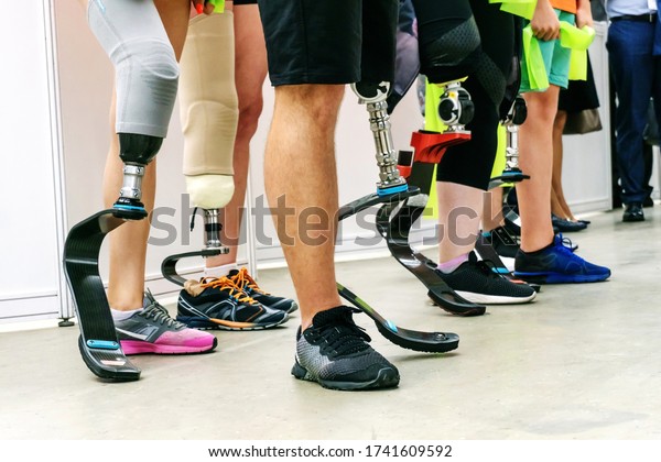 People with disabilities play sports.\
Running leg prosthesis for an active lifestyle. Many athletes with\
amputated legs. Cropped frame. Without a\
face