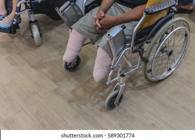 the People Disabled wheelchair leg amputated with hope to future - Powered by Shutterstock