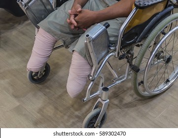 the People Disabled wheelchair leg amputated with hope to future - Powered by Shutterstock