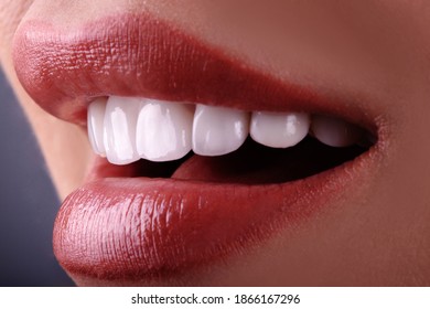 Perfect Close Up Sensual Beautiful Sexy Seductive  Lips Woman  Smile With Tongue . White Teeth Bleaching Ceramic Crowns Whitening Young Lady. Dental Zircon Implants Restoration Treatment  Surgery 