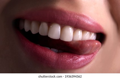 Perfect Close Up White Beautiful Veneers Teeth Bleaching Crowns Whitening Young Lady Smiling, Sensual Sexy Seductive Plump Lips Woman Smile. Dental Zircon Implants Restoration Surgery. Fashion Concept